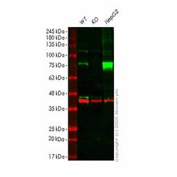 Human ACSL1 knockout HeLa cell line - Abcam plc - Life Sciences