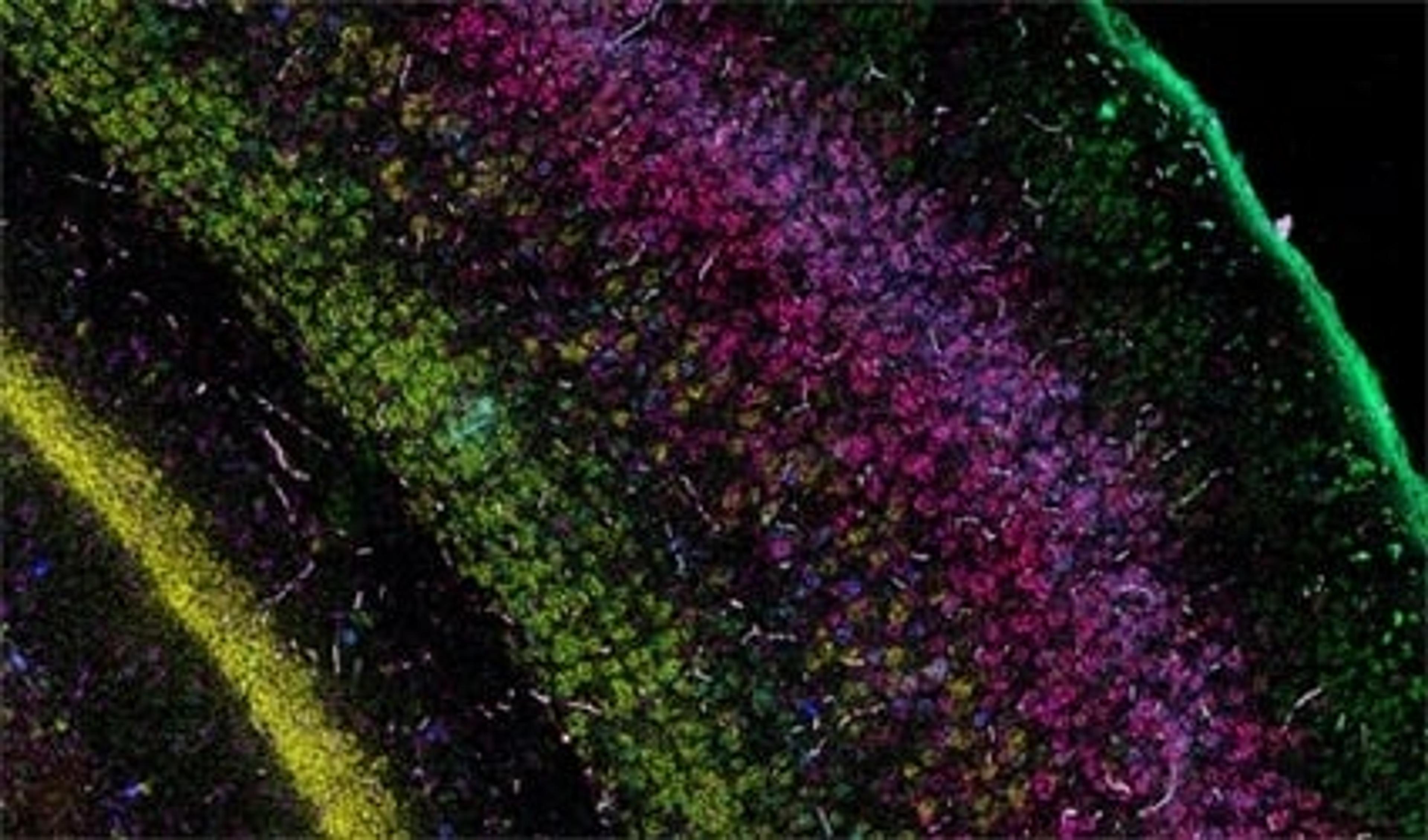 RNAscope™ Multiplex Fluorescent Assays - Advanced Cell Diagnostics - Life Sciences