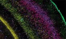 RNAscope™ Multiplex Fluorescent Assays - Advanced Cell Diagnostics - Life Sciences