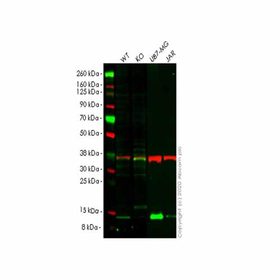 Human CSTB (Cystatin-B) knockout HEK293T cell line - Abcam plc - Life Sciences