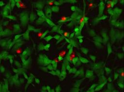 Invitrogen™ LIVE/DEAD™ Cell Imaging Kit (488/570) - Thermo Fisher Scientific - Life Sciences