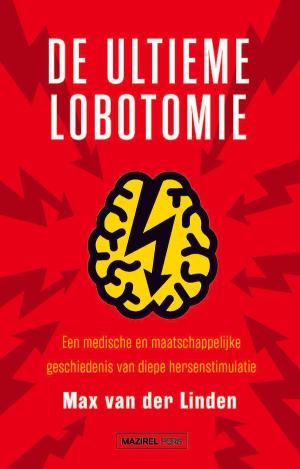 De ultieme lobotomie
