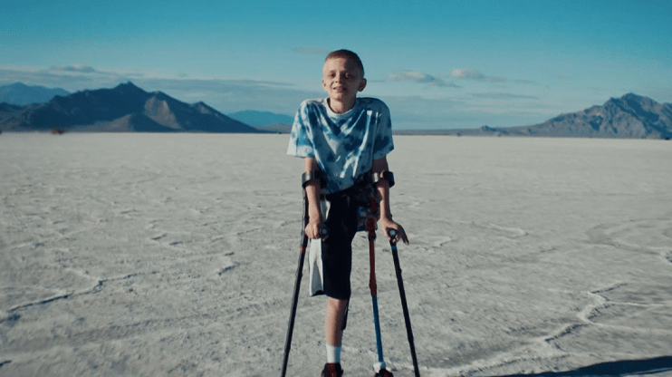 off the breaks documentary NF neurofibromatosis