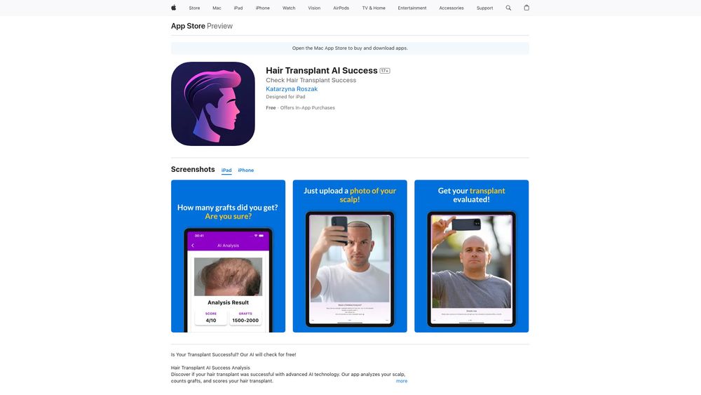 image for Hair Transplant AI Success