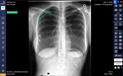 image for DrAid™ - AI for Radiology