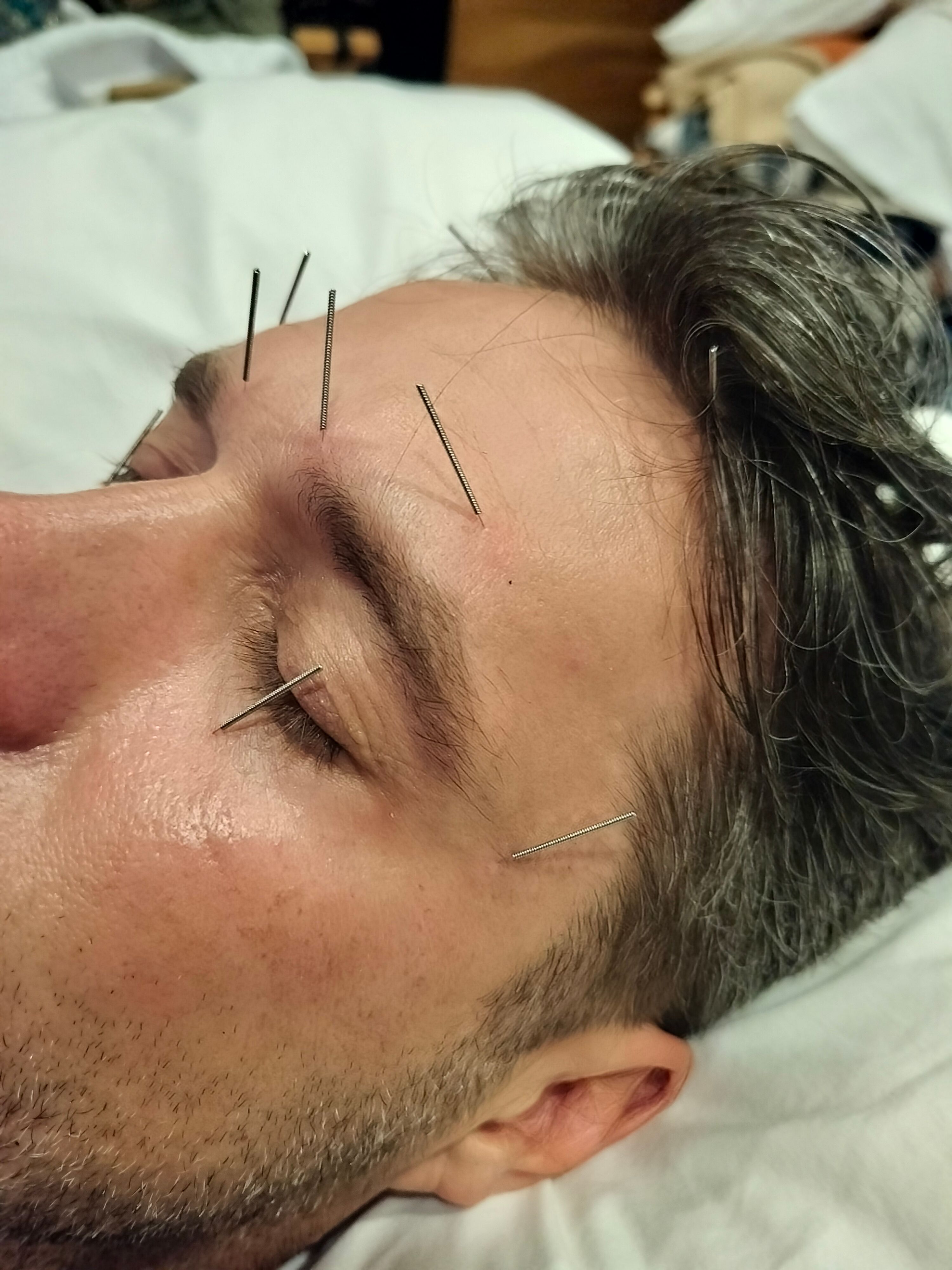 Practitioner giving a facial treatment to a client lying on a mat