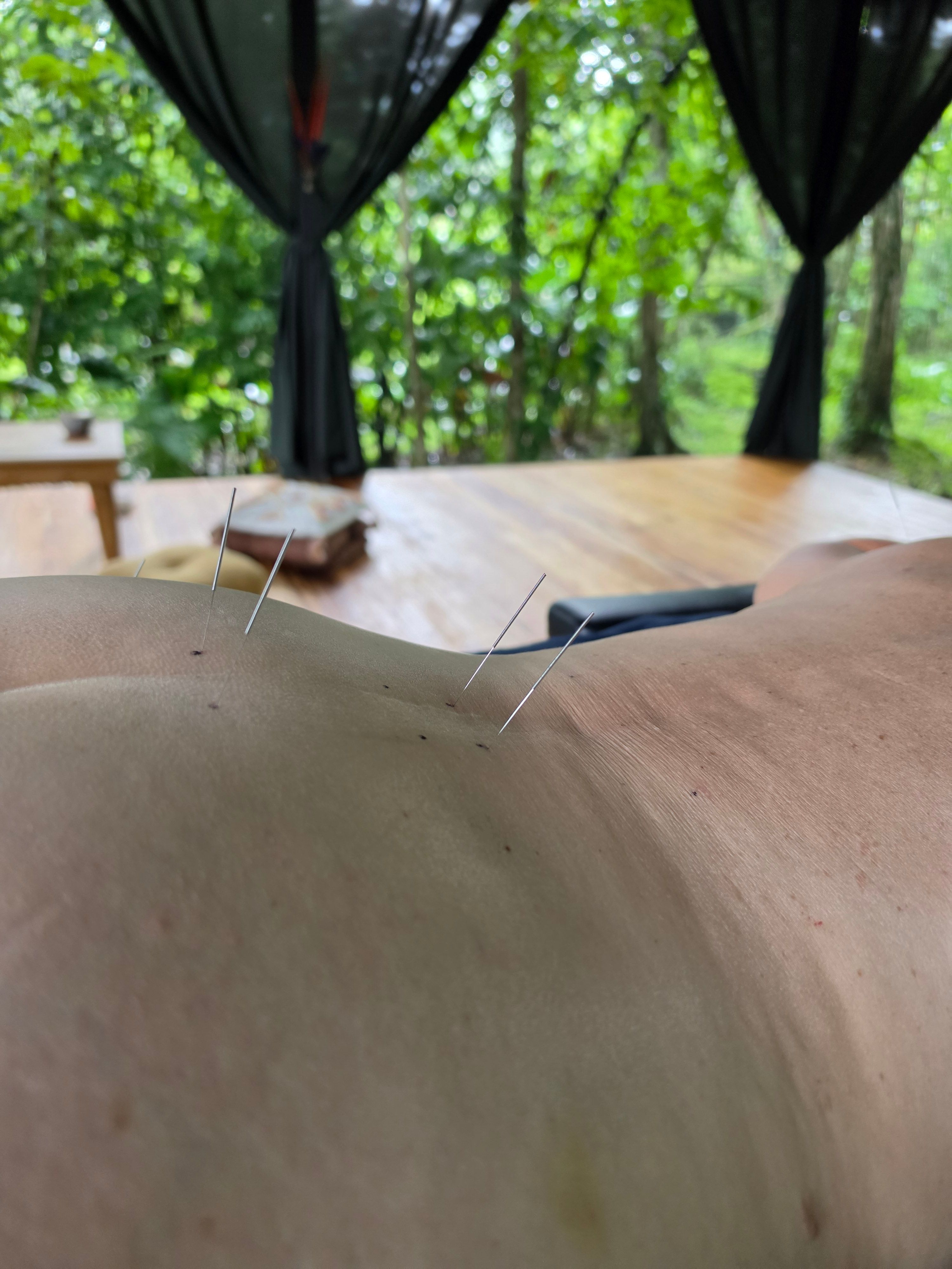 Lower back pain treatment 