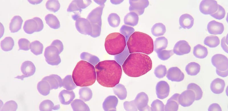 pathology and cancer cell detection
