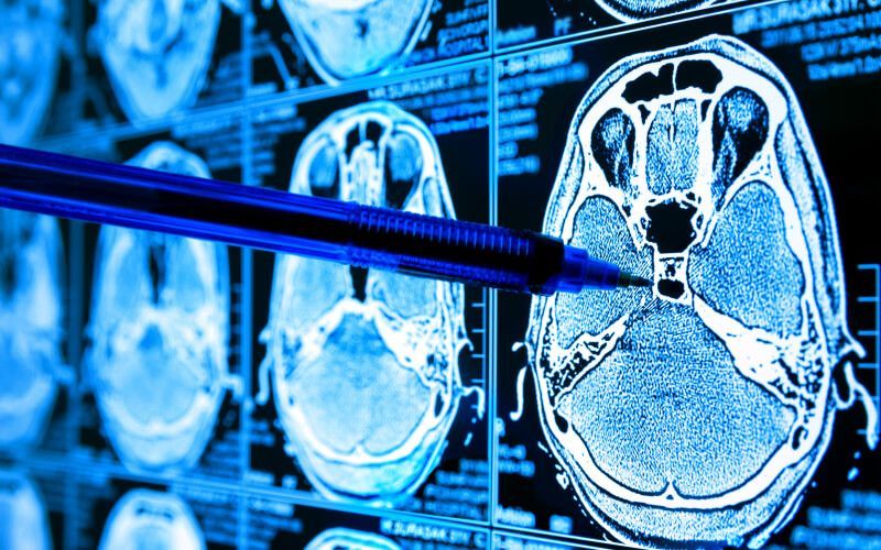 ai in healthcare