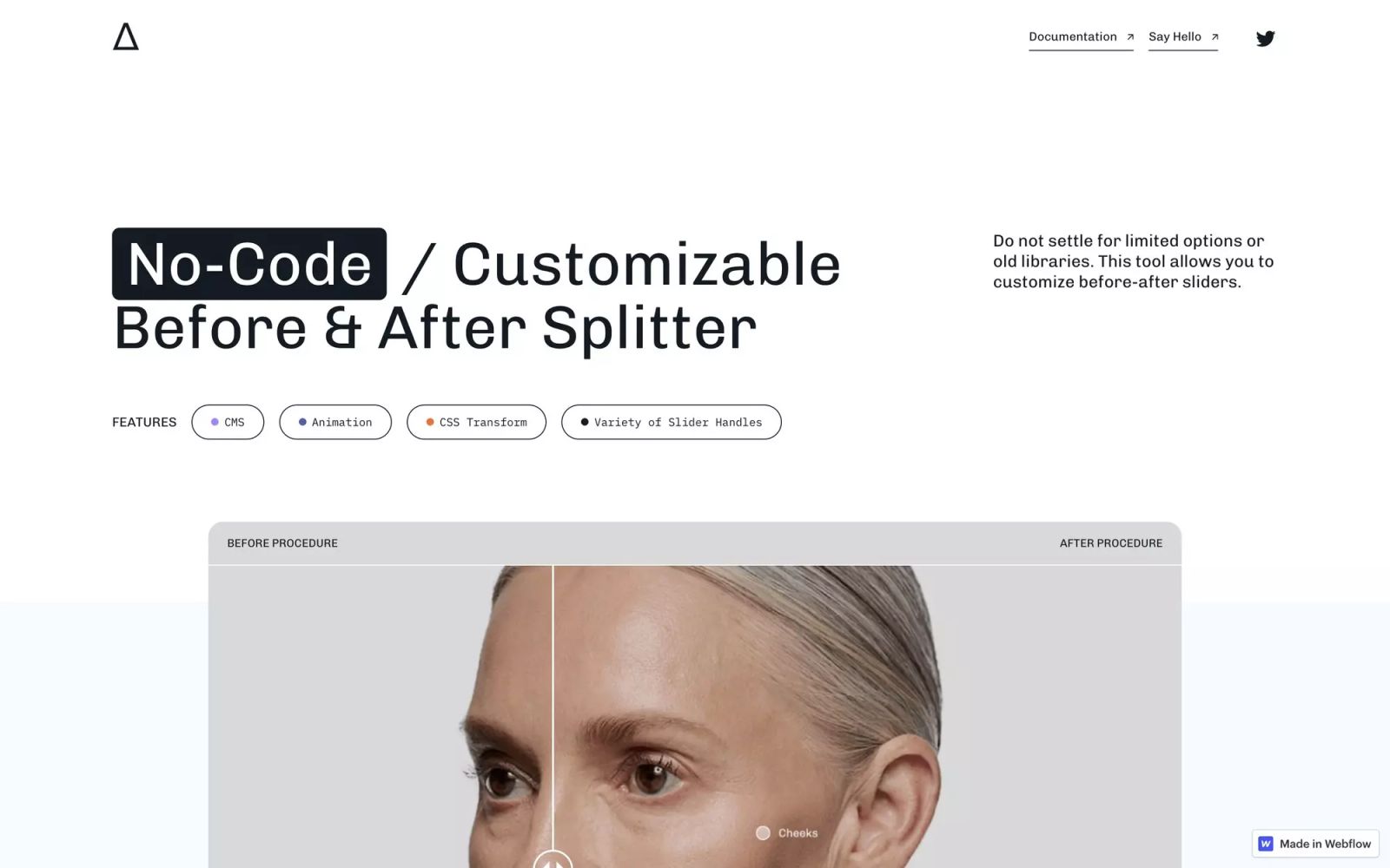 Before/After Splitter