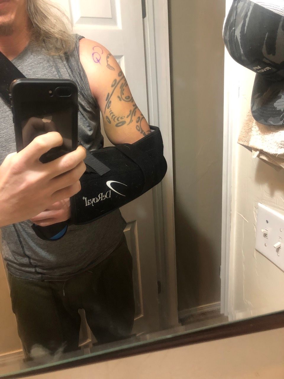 Benjamin Powell Photographs Dropped Bicep Injury