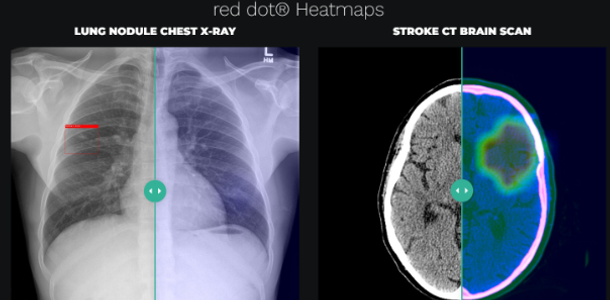 6 AI Applications Already Transforming the Healthcare Industry