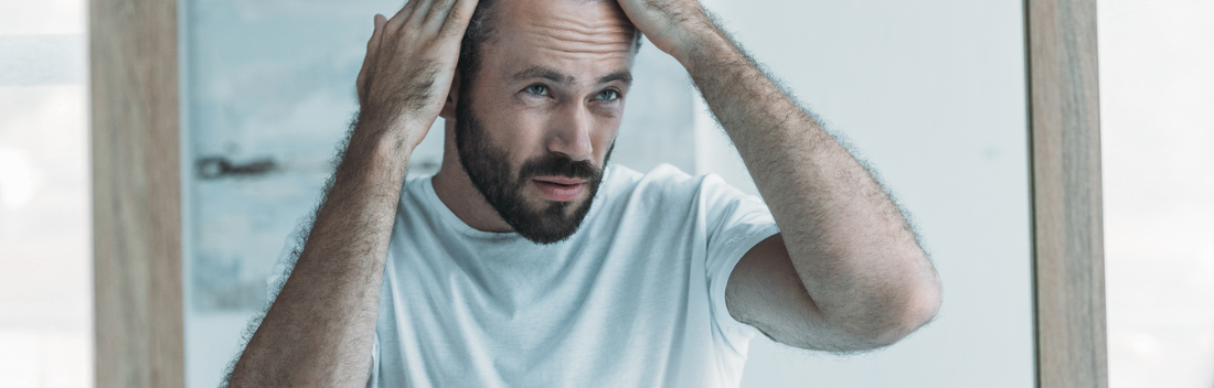 La caída capilar en hombres