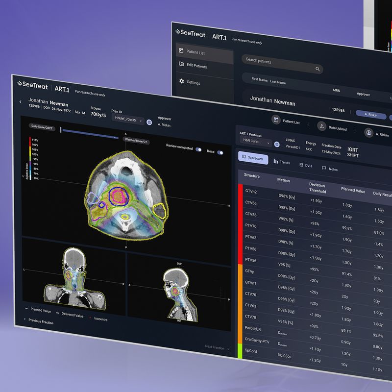 GenesisCare and SeeTreat to bring personalised Offline Adaptive Monitoring to more than 40 radiation oncology centres across Australia