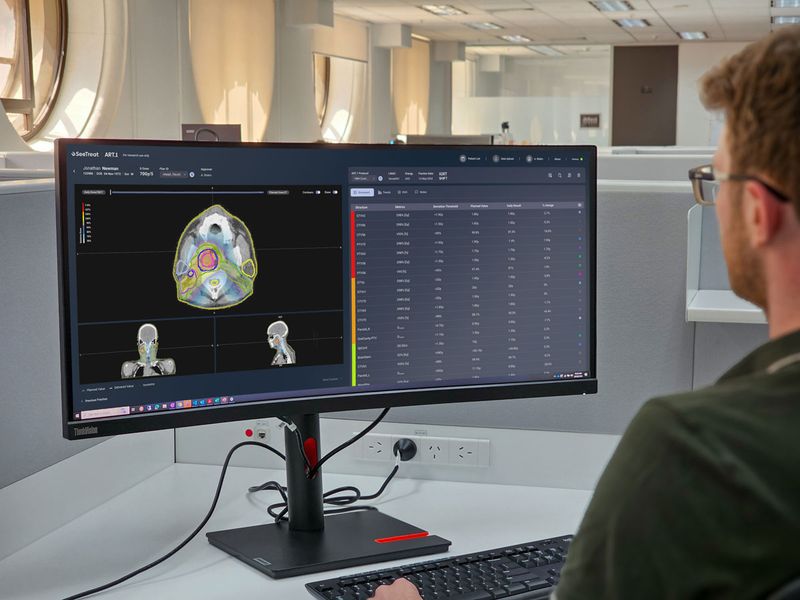 GenesisCare and SeeTreat to bring personalised Offline Adaptive Monitoring to more than 40 radiation oncology centres across Australia