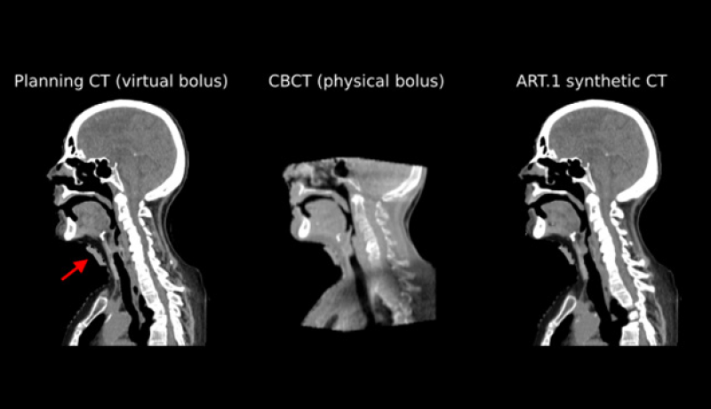 A challenging case - images
