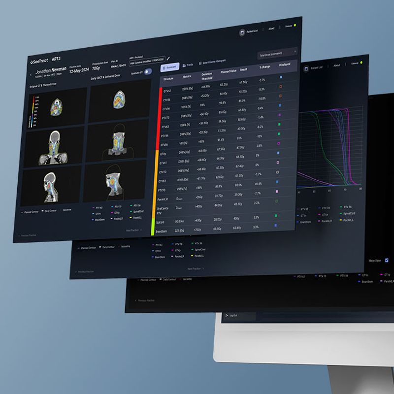 SeeTreat to Launch ART.1 to Support Adaptive Radiotherapy at ESTRO 2025