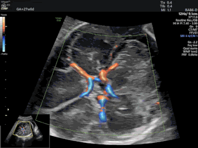 Radiant UltraHD - GE ultrasound feature