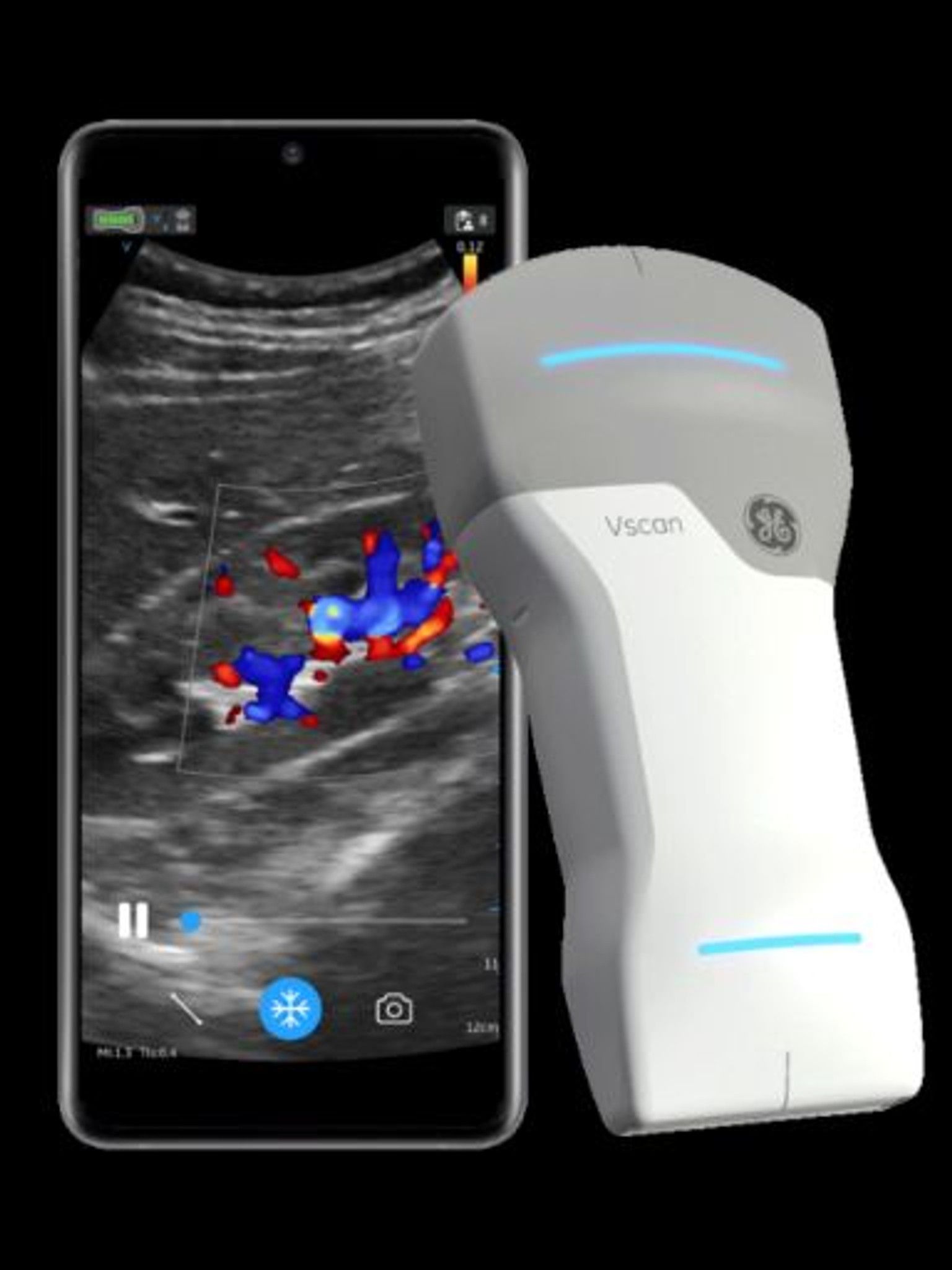 GE Vscan Air | Handheld Point-of-Care Ultrasound | Standard Ultrasound