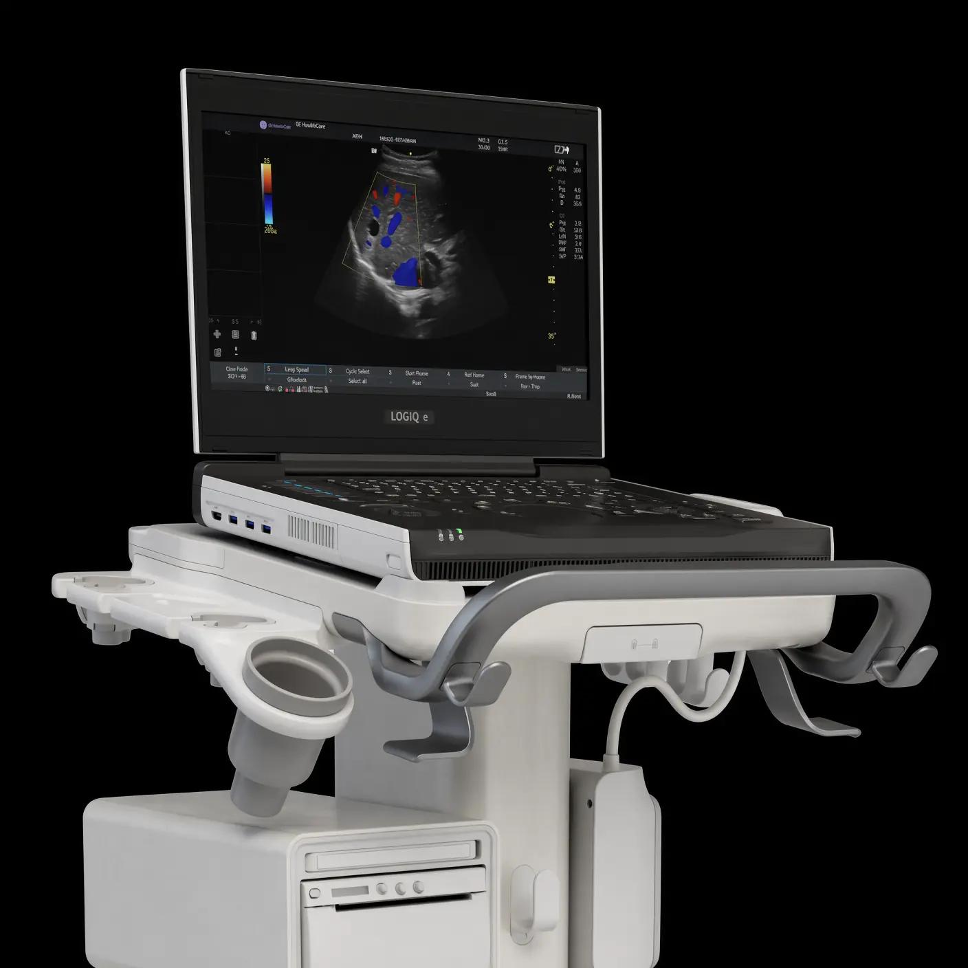 GE LOGIQ P5 Used 3D/4D Ultrasound Machine