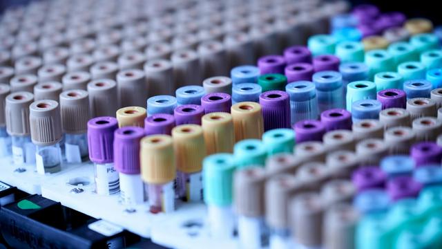 HOMA-IR Explained: The Indian Insulin-Resistance Score (Cutoffs, Interpretation, Reversal)