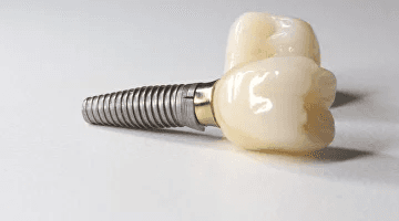 Dental implant post with a ceramic crown