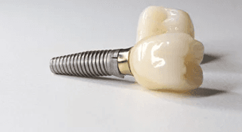 Dental implant post with a ceramic crown