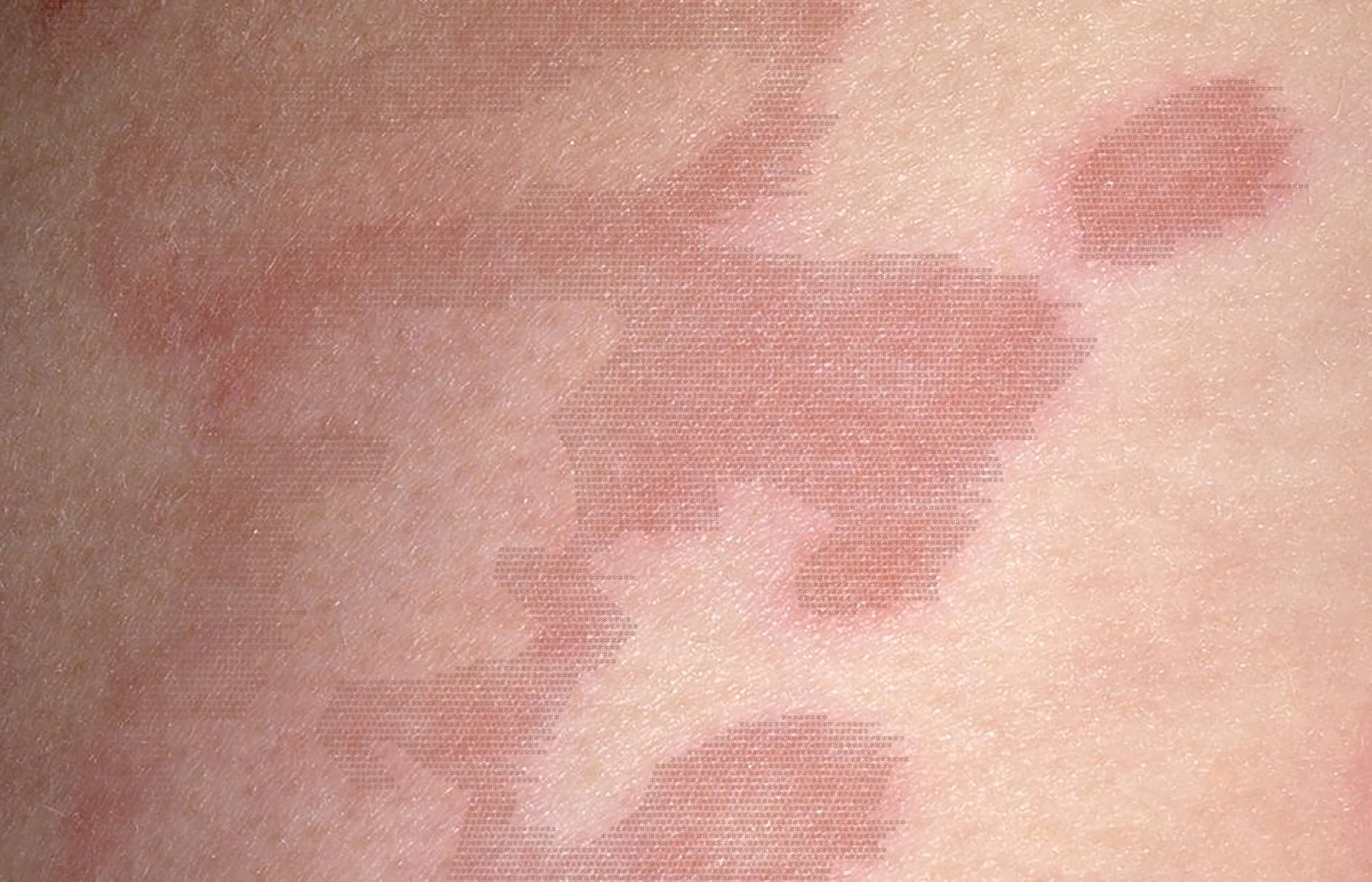 Macro photo of blotchy caucasian  skin