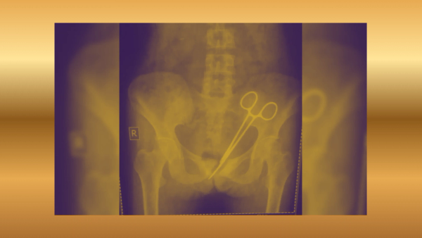  ആരോഗ്യകേരളം: പോസ്റ്ററിൽ തള്ളുകൾ,  വരാന്തകളിൽ  പാവങ്ങൾ, വയറ്റിൽ കത്രിക