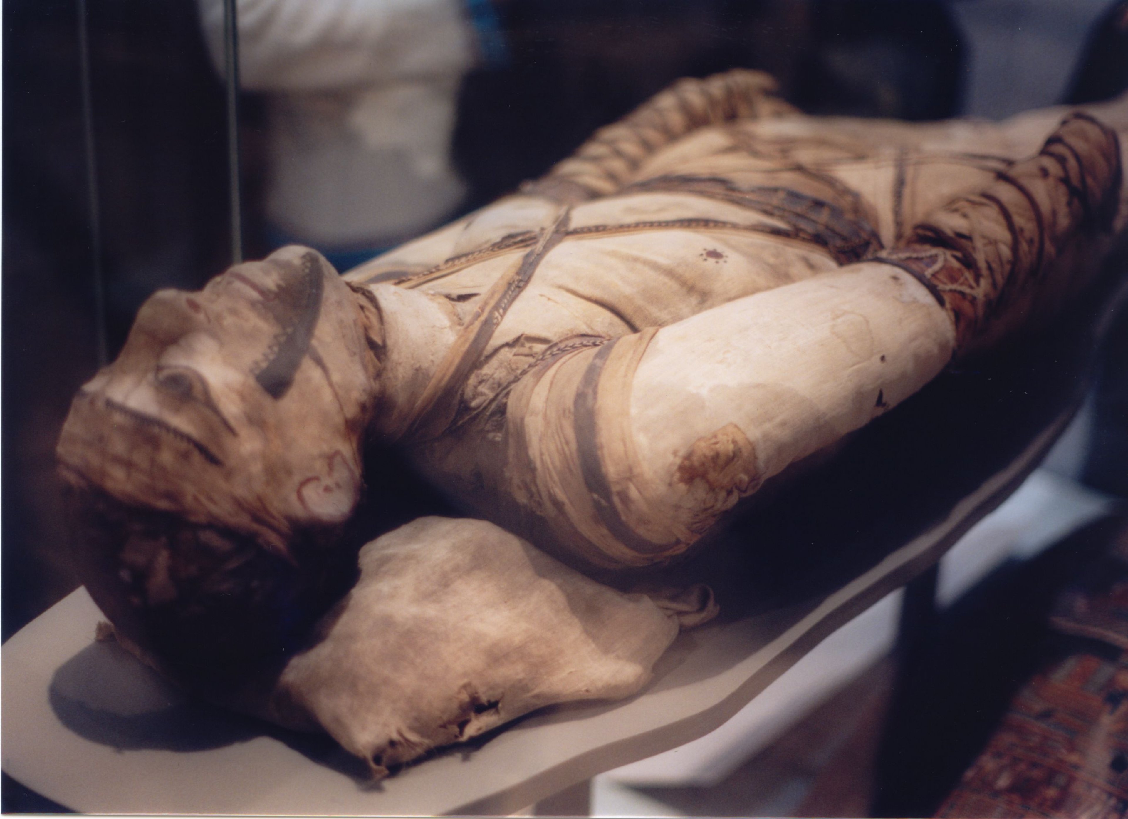 Photograph of an Egyptian Mummy in the British Museum collection where tubercular decay was found in the spine. This photograph has been taken at an angle near the head of the mummy and you ca see part of the main torso and the arms. The Mummy is kept in a glass case.