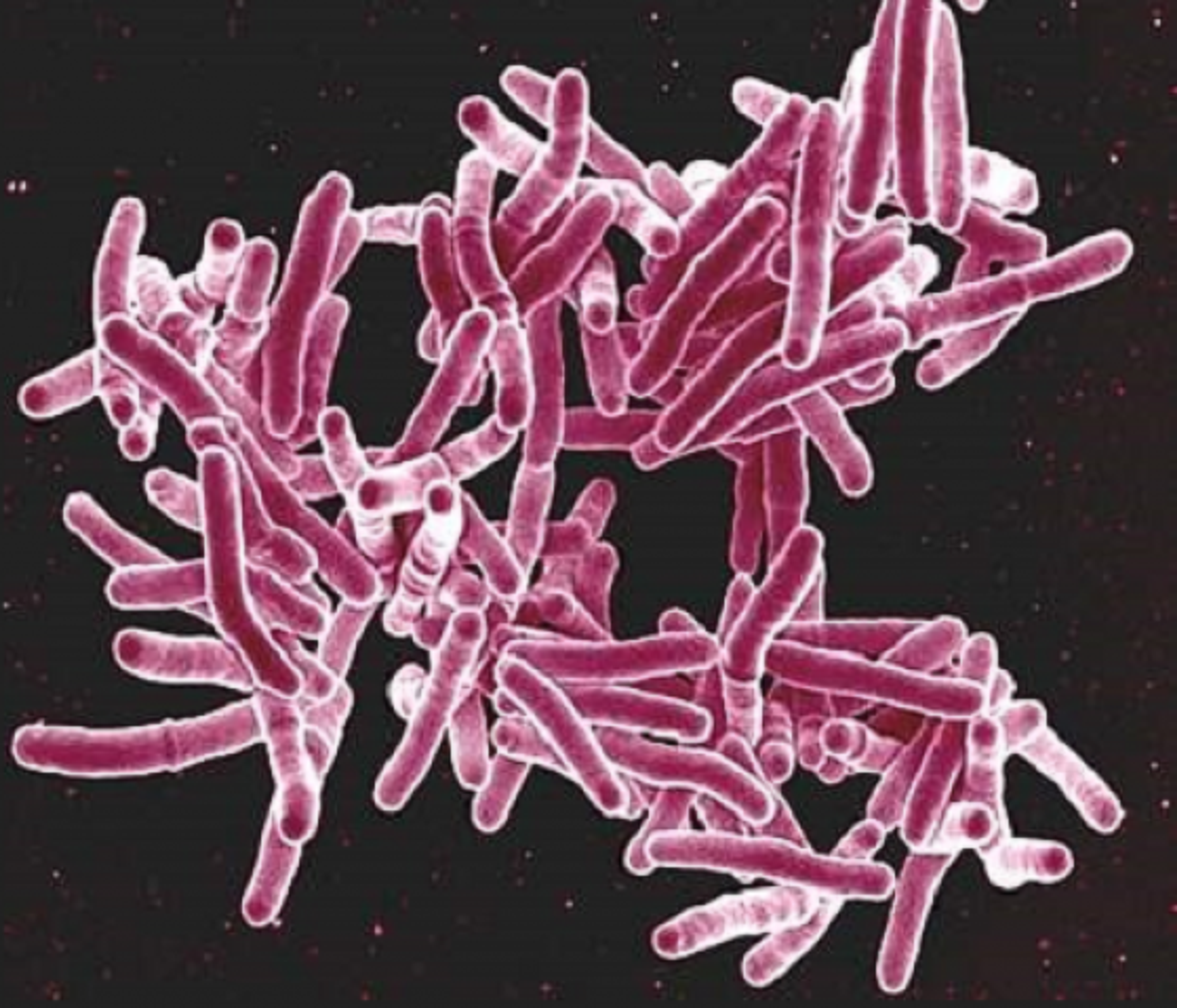 Image showing tuberculosis bacteria under the microscope. The bacteria looks like clusters of deep pink tubes, each coated in white layer/film.