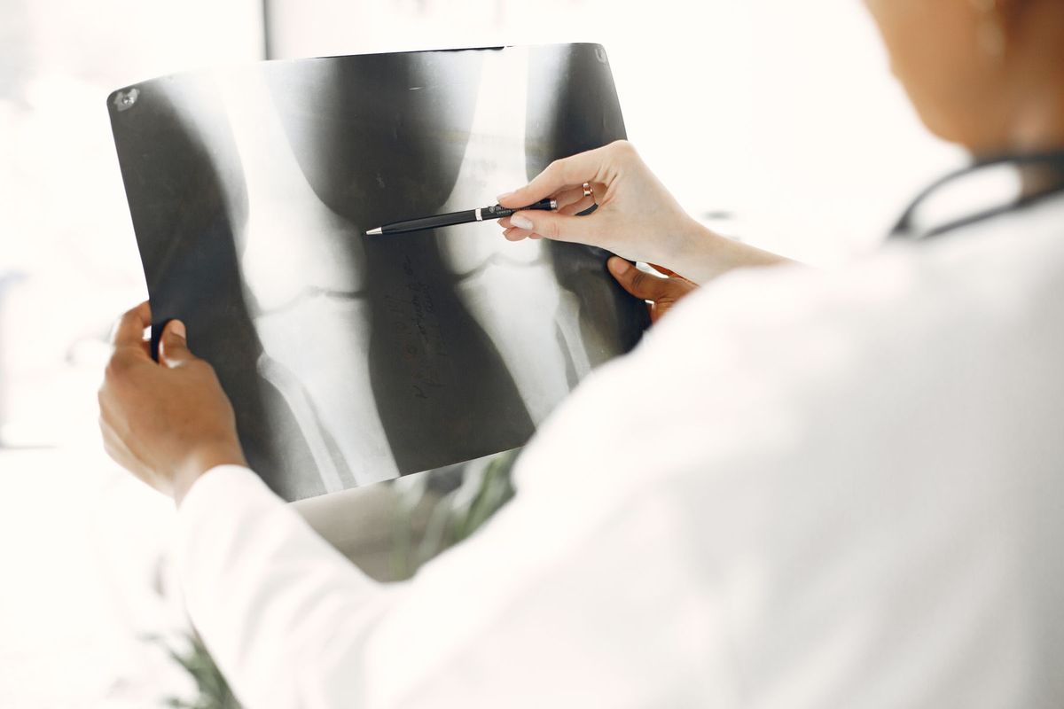 Un rhumatologue examine attentivement une radiographie de jambe en pointant les détails avec un stylo