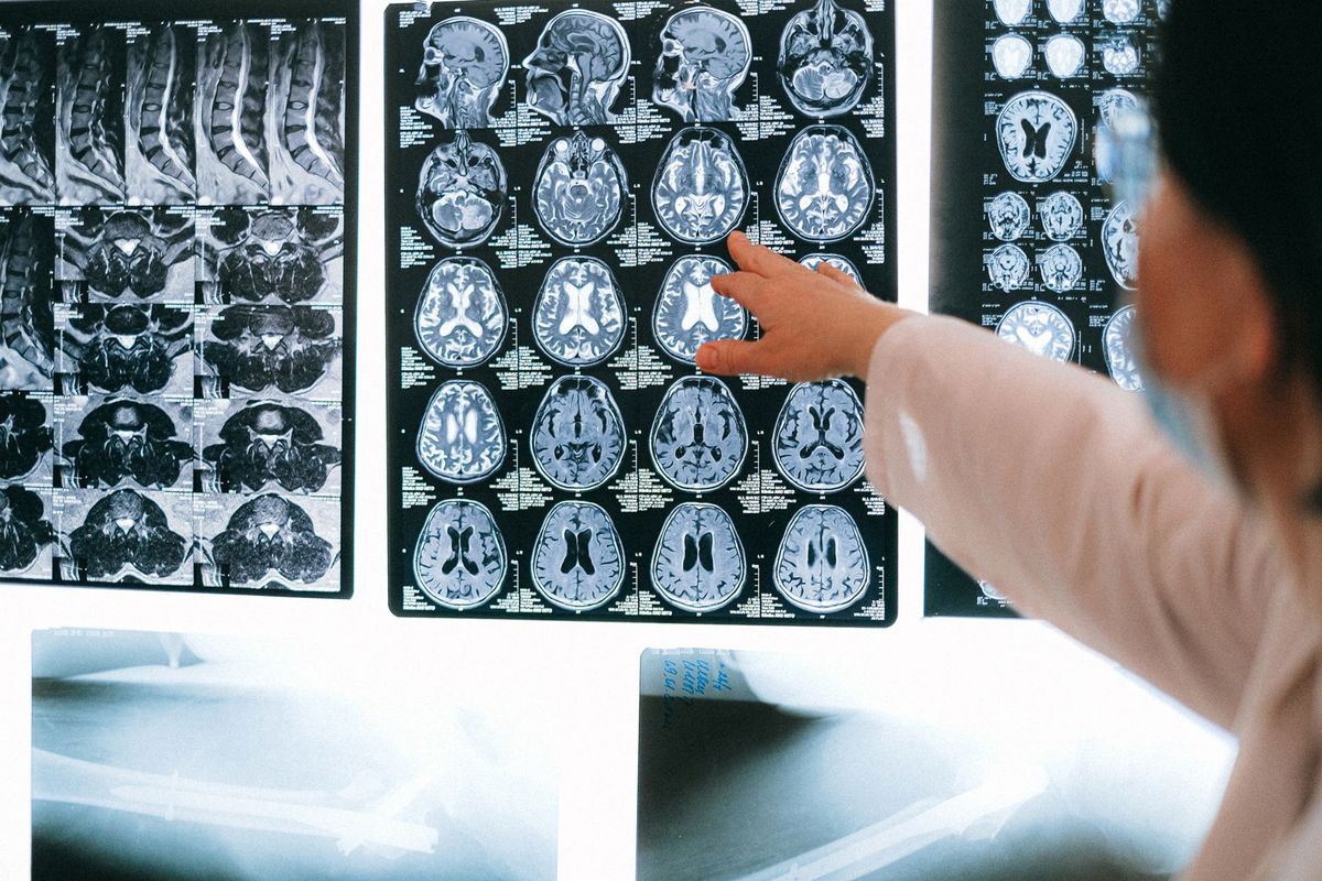 Médecin neurologue examinant des images d'IRM cérébrale sur écran pour diagnostic