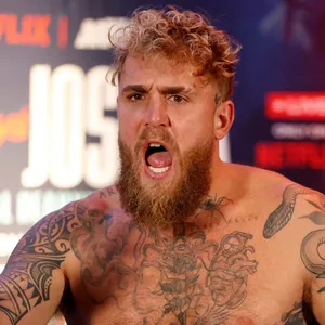 Jake Paul posts X-ray of missing teeth, titanium plates from jaw-breaking loss to AJ