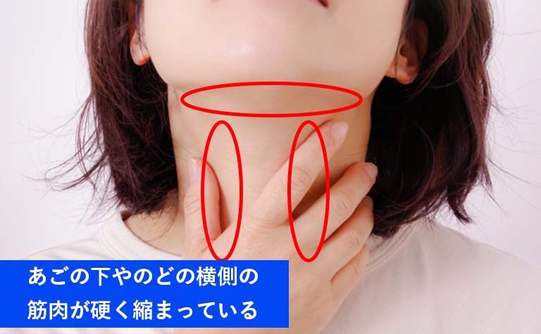 のどの痛みはあごの下やのど周辺の筋肉が硬い