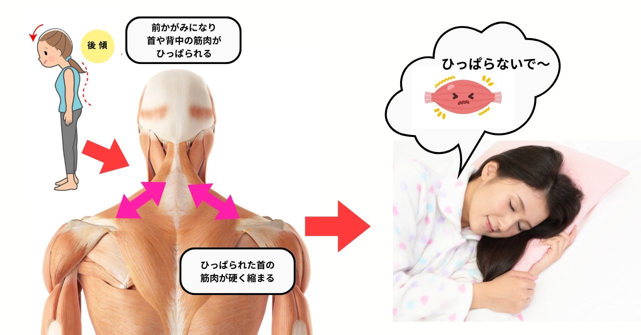 姿勢が前かがみになり肩甲骨まわり筋肉が硬く縮まって寝違え