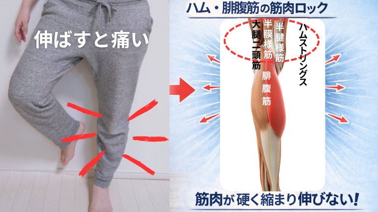 ひざを伸ばすときの痛みの原因