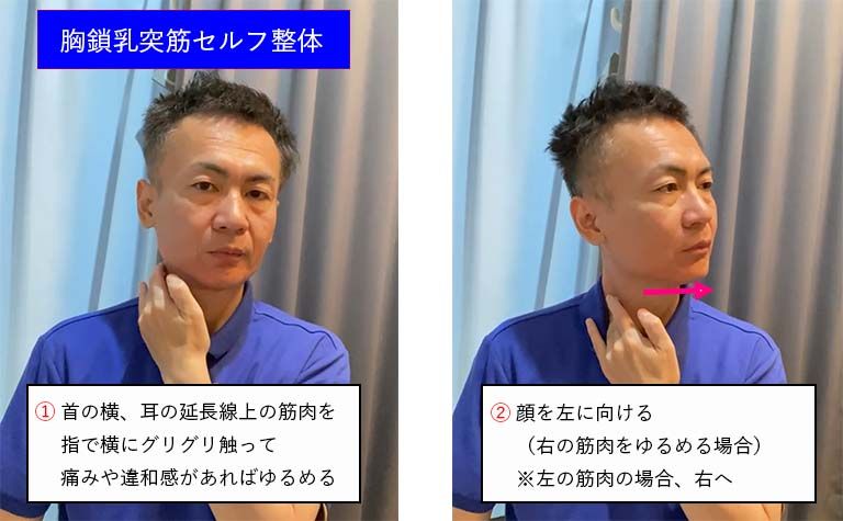 胸鎖乳突筋セルフ整体１