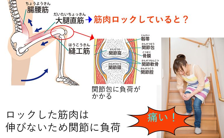 大腿直筋とひざの関係