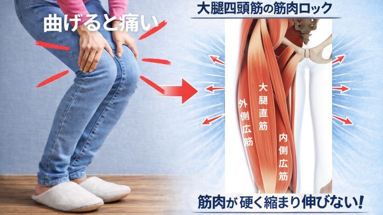 ひざを曲げるときの痛みの原因