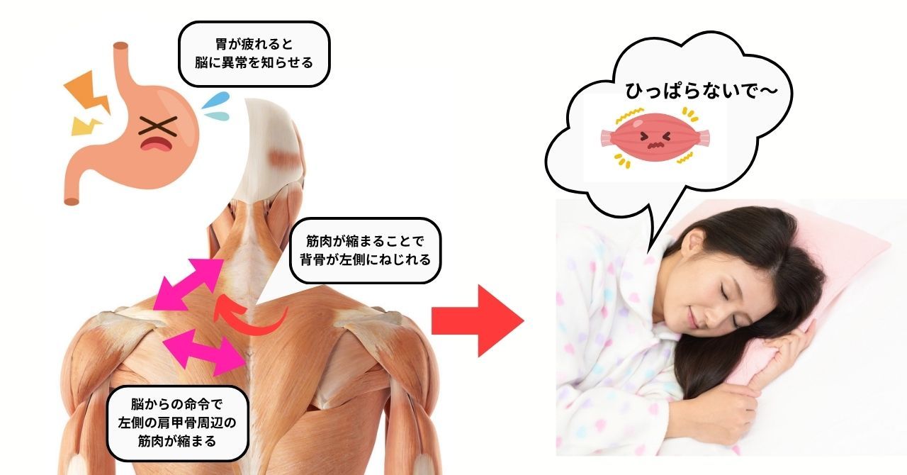 胃の疲れと寝違えの仕組み