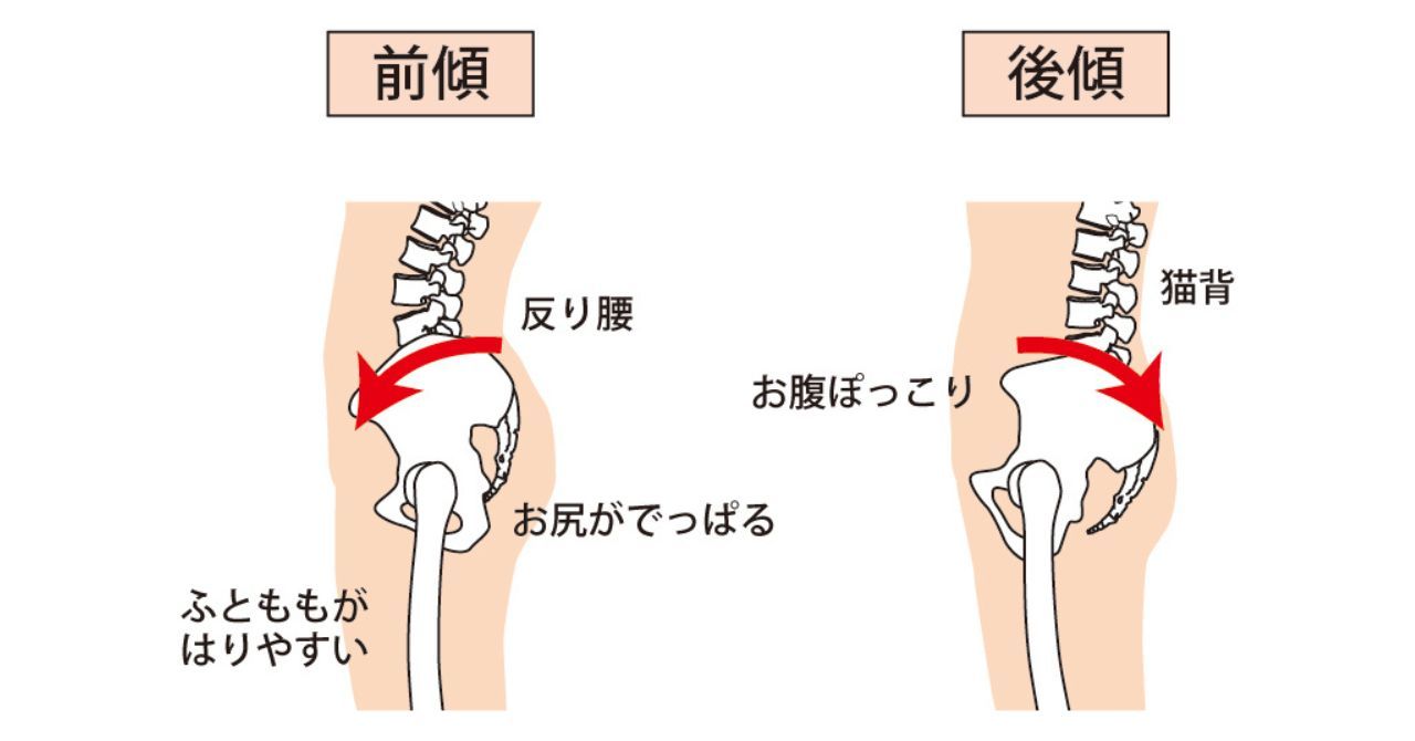 大腰筋のロックでお腹ポッコリで痩せづらくなる