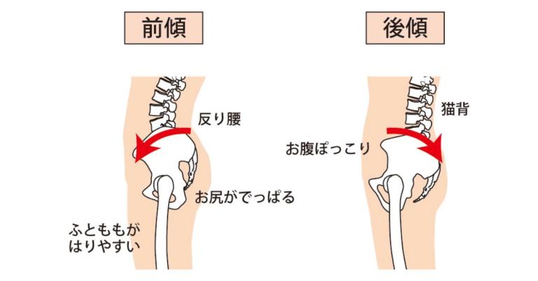 大腰筋のロックでお腹ポッコリで痩せづらくなる