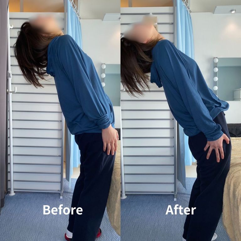 美容師さんの腰痛の施術前後写真