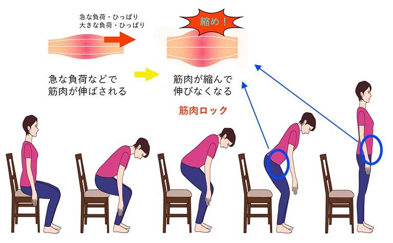 デスクワークに多い腰痛の原因