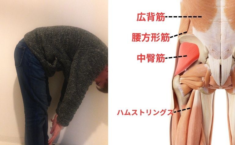 からだを前に曲げると痛む腰痛(屈曲制限腰痛)