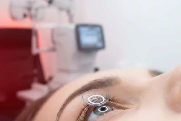 Toric Lenses — Designed for astigmatism.