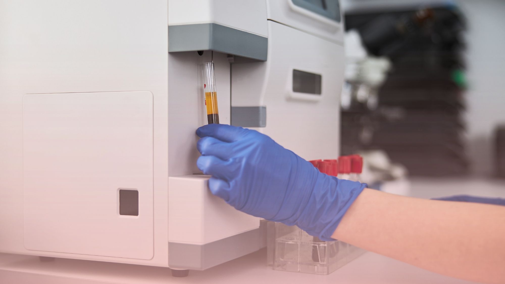 Profesional de laboratorio con guantes procesando muestras de sangre en equipamiento automático para los análisis de nuestro médico hematólogo