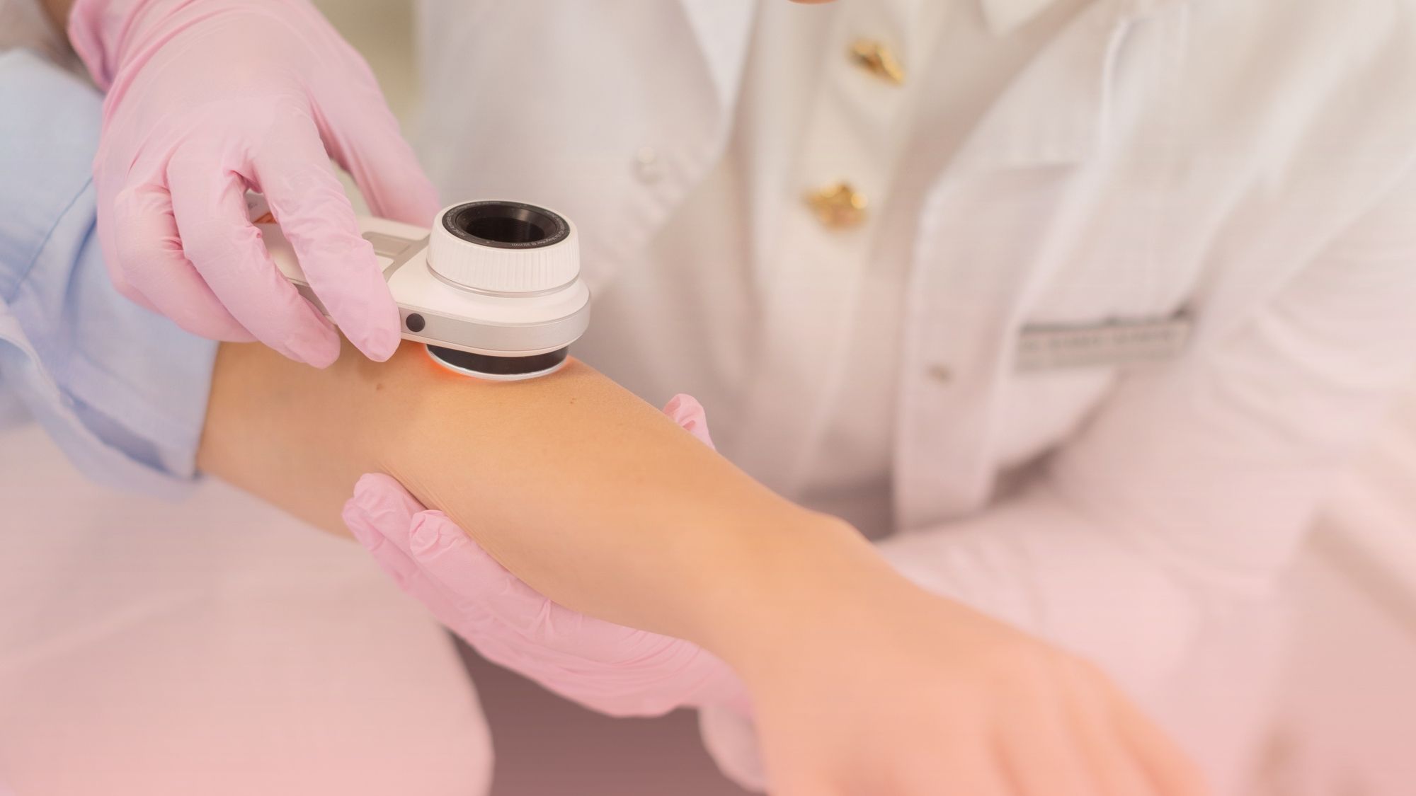 Detalle de las manos de nuestra dermatóloga utilizando un dermatoscopio iluminado para examinar minuciosamente el brazo de un paciente. Una imagen que refleja la precisión médica en el control de lunares y la evaluación de manchas en la piel