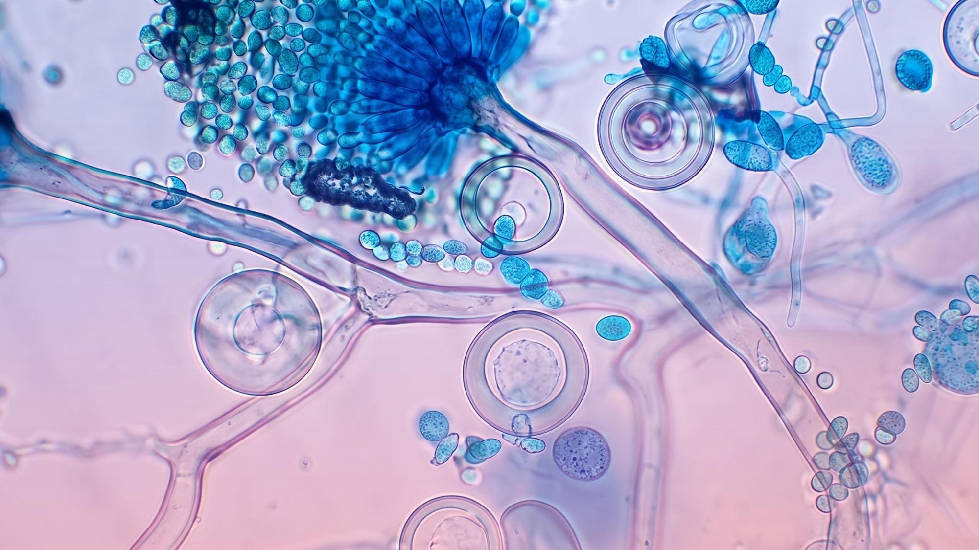 Observación clínica de microorganismos bajo el microscopio. Nuestro médico en GO infectólogo especialista garantiza diagnósticos precisos y tratamientos efectivos para todo tipo de enfermedades infecciosas, bacterianas y virales.